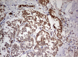 m03258 anti tif1 alpha trim24 mouse monoclonal antibody clone id oti2d9 ihc testing 5