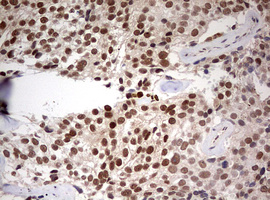 m03258 anti tif1 alpha trim24 mouse monoclonal antibody clone id oti2d9 ihc testing 7