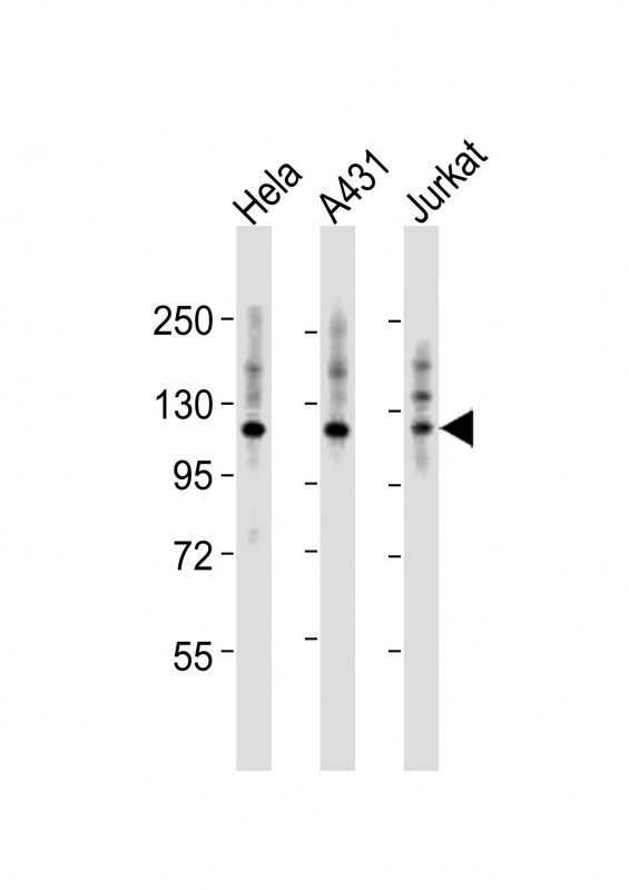 m03267 anti itga7 antibody n term wb testing 2
