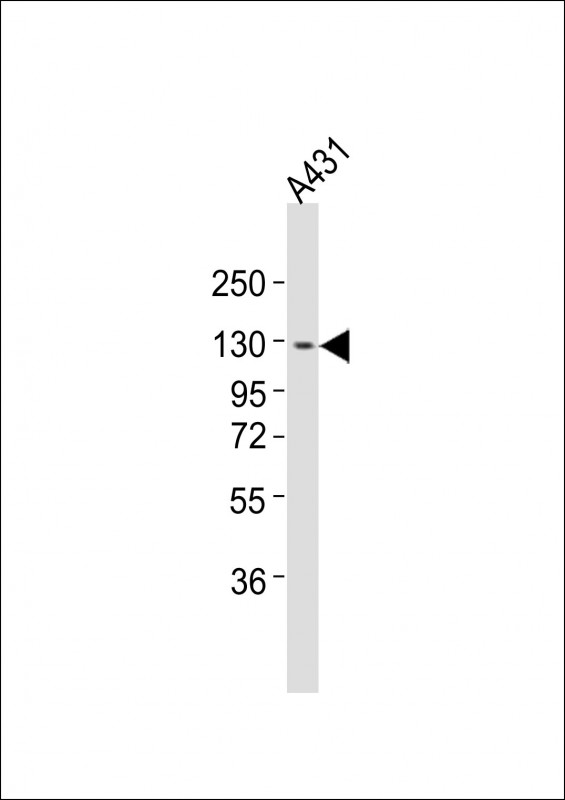 m03267 anti itga7 antibody n term wb testing 3