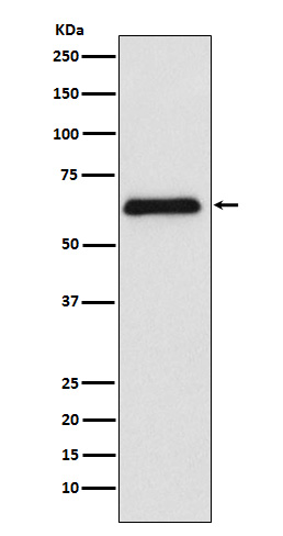Western blot analysis of PARP2 expression in Raji cell lysate