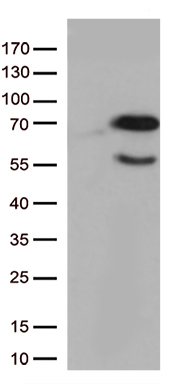 HEK293T cells were transfected with the pCMV6-ENTRY control (Left lane) or pCMV6-ENTRY GNL3 (Right lane) cDNA for 48 hrs and lysed