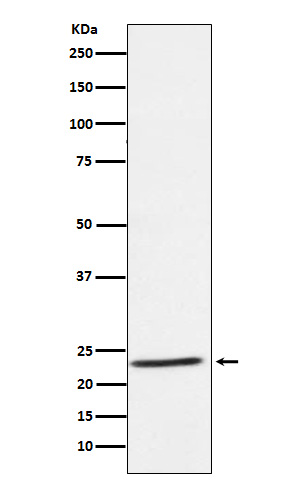 Western blot analysis of IL32 expression in Human tonsil lysate