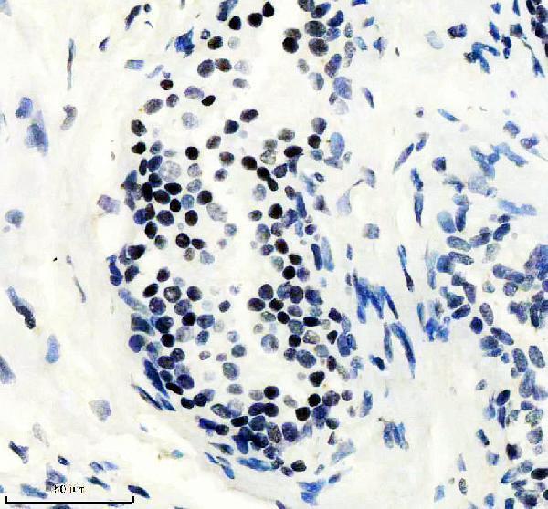 IHC analysis of PHF8 using anti-PHF8 antibody (M03288)