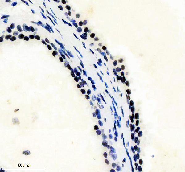 IHC analysis of PHF8 using anti-PHF8 antibody (M03288)