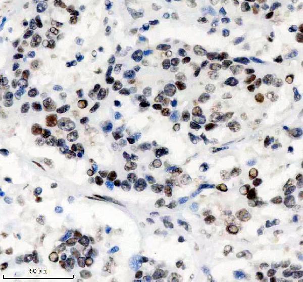 m03288 phf8 primary antibodies ihc testing 3