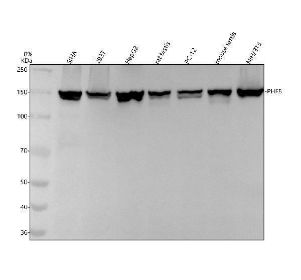 Western blot analysis of PHF8 using anti-PHF8 antibody (M03288)