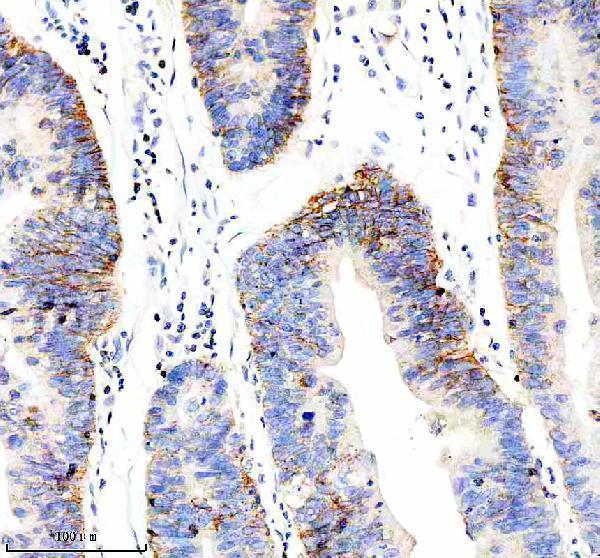  IHC analysis of PRKCH using anti-PRKCH antibody (M03292)
