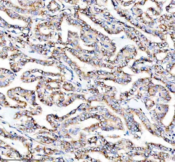  IHC analysis of PRKCH using anti-PRKCH antibody (M03292)