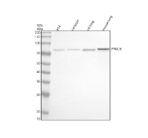  Western blot analysis of PKC Eta/PRKCH using anti-PKC Eta/PRKCH antibody (M03292)