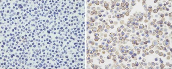 Immunohistochemical analysis of PDL-2 in untransfected(left) or transfected(right) with 293T cell sections