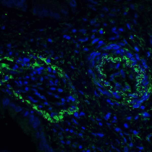 m03295 pdcd1lg2 primary antibodies if testing 5