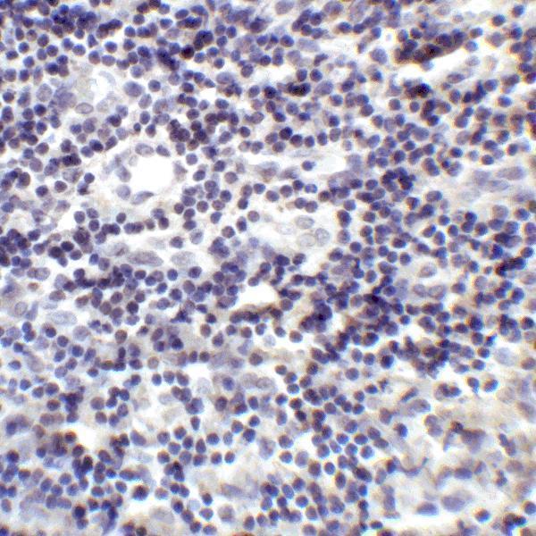 m03295 pdcd1lg2 primary antibodies ihc testing 6
