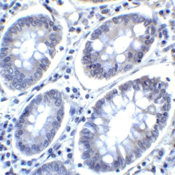 m03295 pdcd1lg2 primary antibodies ihc testing 7