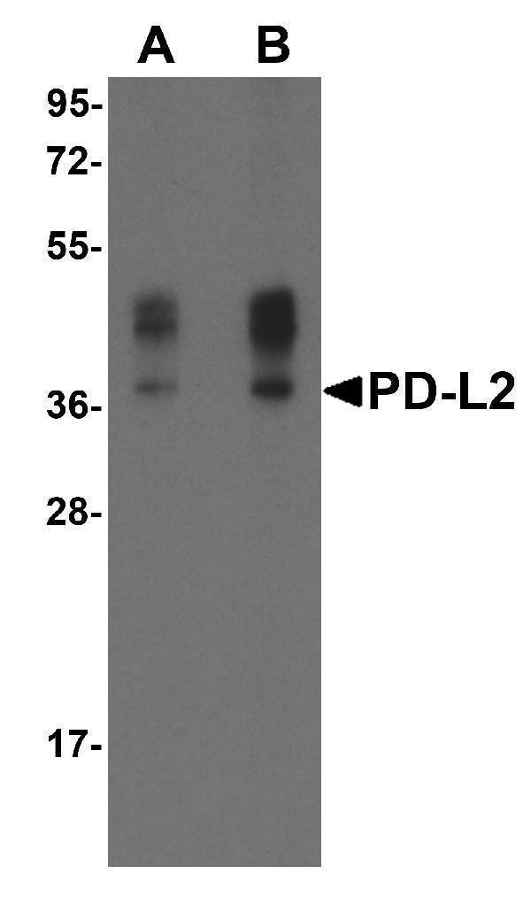 Western blot analysis of PD-L2 in overexpressing HEK293 cells PD-L2 antibody at 0