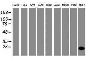 Western blot analysis of extracts (35ug) from 9 different cell lines by usin g anti-CRABP2 monoclonal antibody (HepG2: human; HeLa: human; SVT2: mouse; A549: human; COS7: monkey; Jurkat: human; MDCK: canine; PC12: rat; MCF7: human)