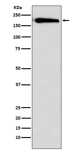 Western blot analysis of SMARCC1 expression in HeLa cell lysate