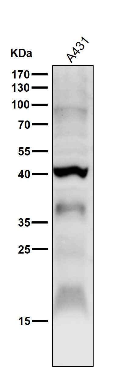 All lanes use the Antibody at 1:1K dilution for 1 hour at room temperature. All lanes use the Antibody at 1:1K dilution for 1 hour at room temperature.