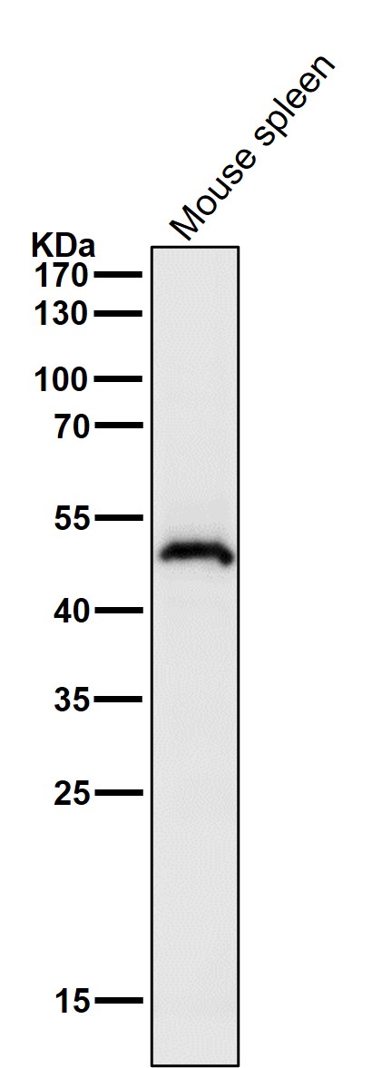 Anti-HOXA13 Rabbit Monoclonal Antibody Anti-HOXA13 Rabbit Monoclonal Antibody