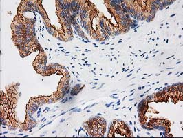 m03306 1 anti baiap2 mouse monoclonal antibody clone id oti 1d9 ihc testing 4