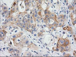 m03306 1 anti baiap2 mouse monoclonal antibody clone id oti 1d9 ihc testing 5