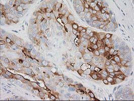 m03306 1 anti baiap2 mouse monoclonal antibody clone id oti 1d9 ihc testing 6