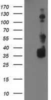 HEK293T cells were transfected with the pCMV6-ENTRY control (Left lane) or pCMV6-ENTRY BAIAP2 (Right lane) cDNA for 48 hrs and lysed