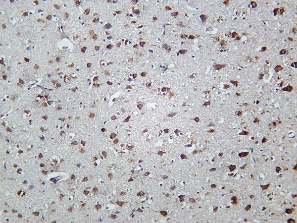 Rat brain was stained with Anti-FXR1 rabbit antibody