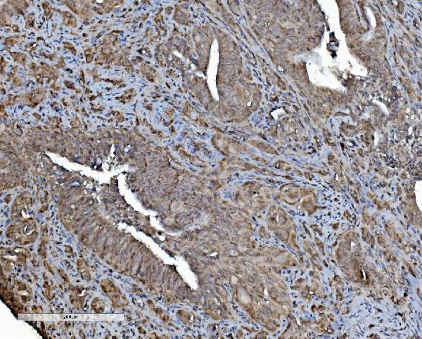 m03315 phb2 primary antibodies ihc testing 2