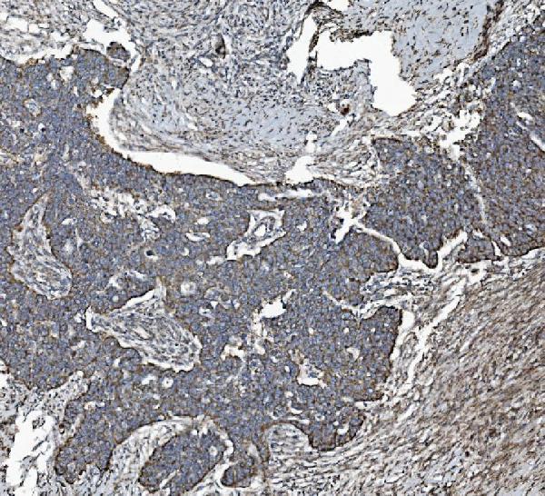 m03315 phb2 primary antibodies ihc testing 3