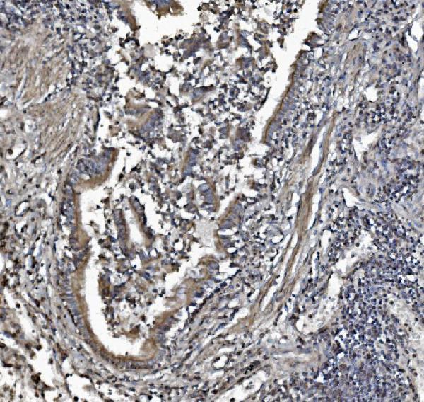 m03315 phb2 primary antibodies ihc testing 5