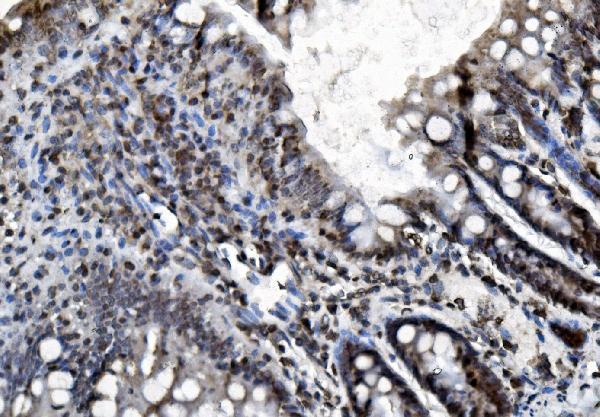 m03315 phb2 primary antibodies ihc testing 7