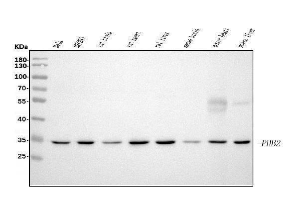 m03315 phb2 primary antibodies wb testing 1
