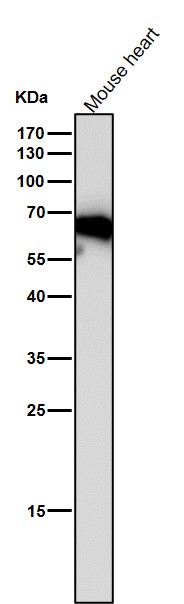 All lanes use the Antibody at 1:4K dilution for 1 hour at room temperature