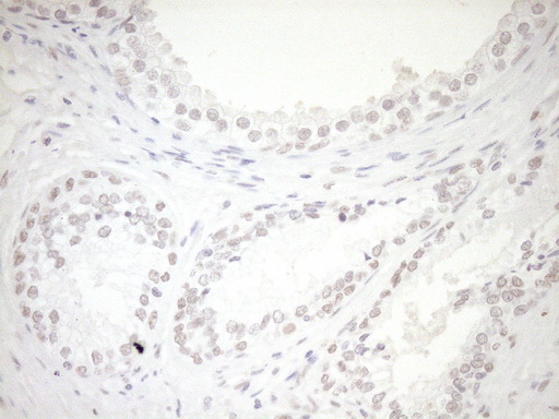 m03331 1 anti lxr alpha nr1h3 mouse monoclonal antibody clone id oti1a5 ihc testing 11
