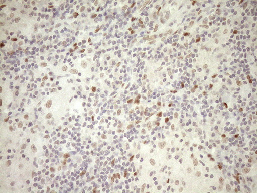 m03331 1 anti lxr alpha nr1h3 mouse monoclonal antibody clone id oti1a5 ihc testing 14