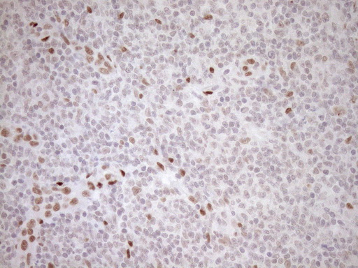 m03331 1 anti lxr alpha nr1h3 mouse monoclonal antibody clone id oti1a5 ihc testing 15