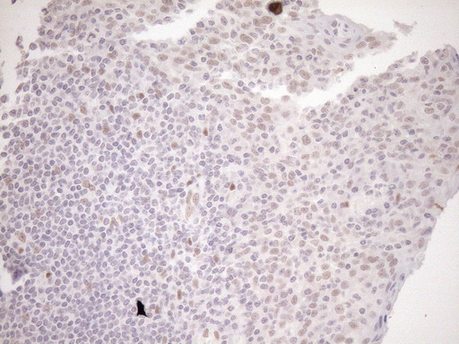 m03331 1 anti lxr alpha nr1h3 mouse monoclonal antibody clone id oti1a5 ihc testing 16