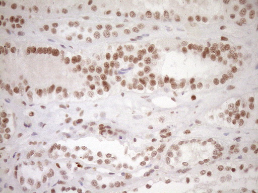 m03331 1 anti lxr alpha nr1h3 mouse monoclonal antibody clone id oti1a5 ihc testing 17
