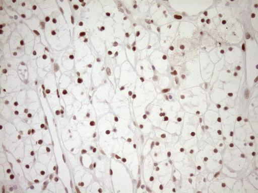 m03331 1 anti lxr alpha nr1h3 mouse monoclonal antibody clone id oti1a5 ihc testing 18