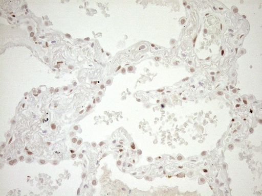 m03331 1 anti lxr alpha nr1h3 mouse monoclonal antibody clone id oti1a5 ihc testing 3