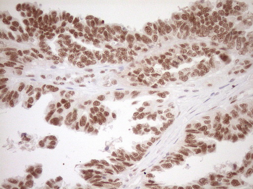 m03331 1 anti lxr alpha nr1h3 mouse monoclonal antibody clone id oti1a5 ihc testing 5