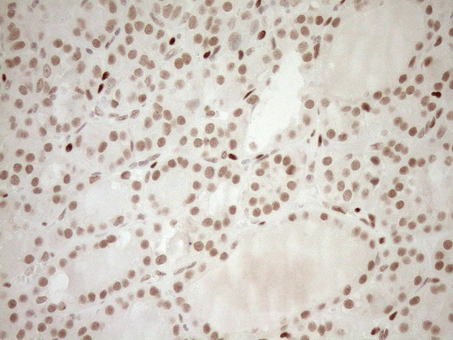m03331 1 anti lxr alpha nr1h3 mouse monoclonal antibody clone id oti1a5 ihc testing 7