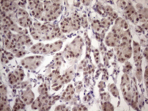 Immunohistochemical staining of paraffin-embedded Human pancreas tissue within the normal limits using anti-ESRRA mouse monoclonal antibody