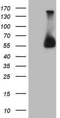 HEK293T cells were transfected with the pCMV6-ENTRY control (Left lane) or pCMV6-ENTRY ESRRA (Right lane) cDNA for 48 hrs and lysed