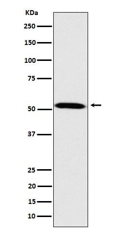Western blot analysis of Fukutin expression in HeLa cell lysate.