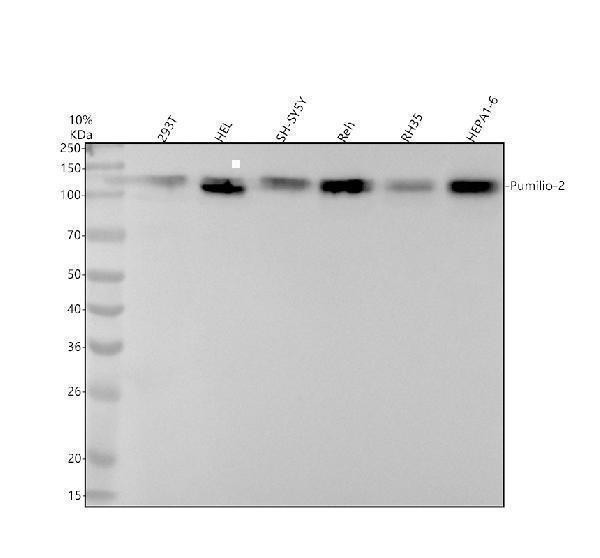 Western blot analysis of Pumilio-2 using anti-Pumilio-2 antibody (M03347)