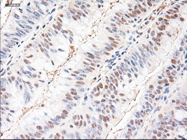 m03348 anti neurotrophin 3 ntf3 mouse monoclonal antibody clone id oti5c7 ihc testing 11