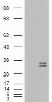 HEK293T cells were transfected with the pCMV6-ENTRY control (Left lane) or pCMV6-ENTRY NTF3 (Right lane) cDNA for 48 hrs and lysed