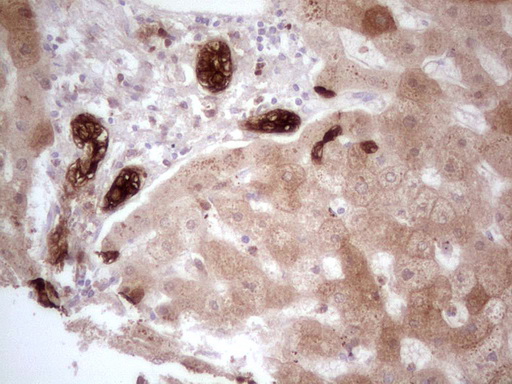 Immunohistochemical staining of paraffin-embedded Human liver tissue within the normal limits using anti-PHGDH mouse monoclonal antibody